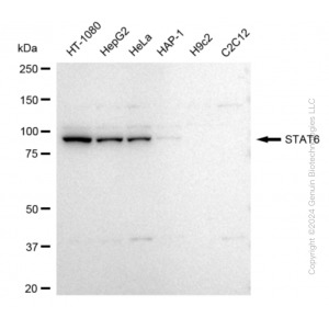 KD-Validated STAT6 Rabbit mAb (20 μl)