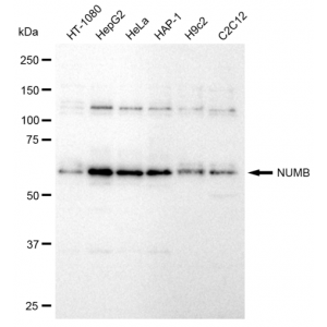 KD-Validated NUMB Rabbit mAb (20 μl)