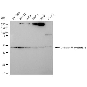 KD-Validated GSS Rabbit mAb (20 μl)