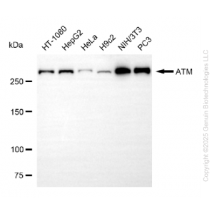 KO-Validated ATM Rabbit mAb (20 μl)