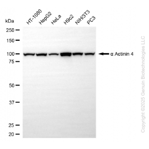 KO-Validated ACTN4 Rabbit mAb (20 μl)