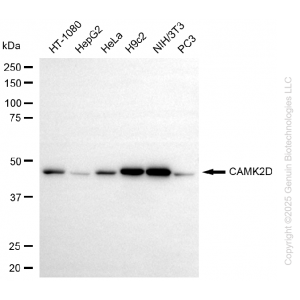 KO-Validated CAMK2D Rabbit mAb (20 μl)