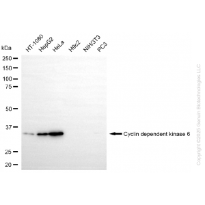KO-Validated CDK6 Rabbit mAb (20 μl)