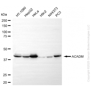 KO-Validated ACADM Rabbit mAb (20 μl)
