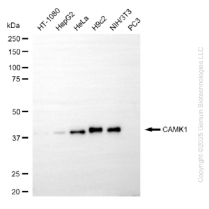 KO-Validated CAMK1 Rabbit mAb (20 μl)