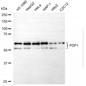 KO-Validated PDP1 Mouse Oligoclonal Antibody (20 μl)