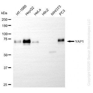 KO-Validated YAP1 Rabbit mAb (20 μl)