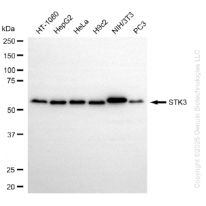 KO-Validated STK3 Rabbit mAb (20 μl)