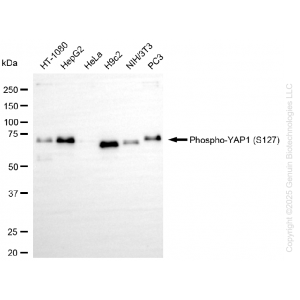 KO-Validated Phospho-YAP1 (S127) Rabbit mAb (20 μl)