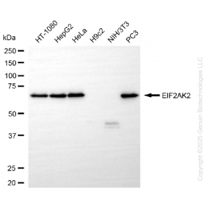 71234-WB-1-300x300-1.webp KO-Validated EIF2AK2 Rabbit mAb (20 μl)
