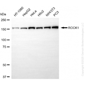71235-WB-1-300x300-1.webp KO-Validated ROCK1 Rabbit mAb (20 μl)