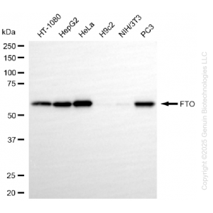 71241-WB-1-300x300-1.webp KO-Validated FTO Rabbit mAb (20 μl)