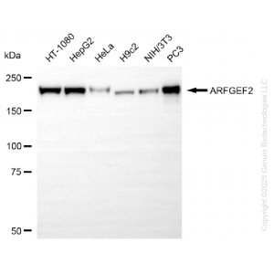 71258-WB-1-300x300-1.webp KO-Validated ARFGEF2 Rabbit mAb (20 μl)