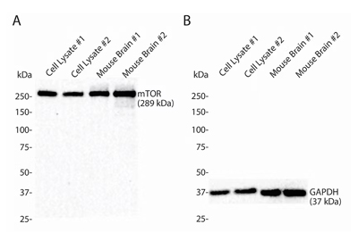 Cell Lysis Ripa Buffer