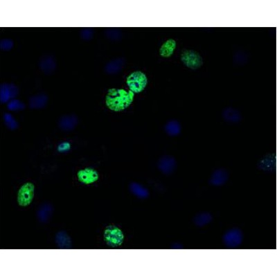 Cell-Proliferation-Assay-Kits-8-400x400 LiFluor™ 488 EU Imaging Kit (50 rxns)